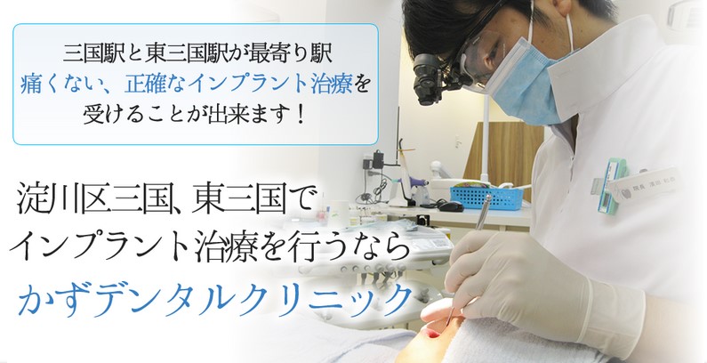 淀川区でインプラント治療